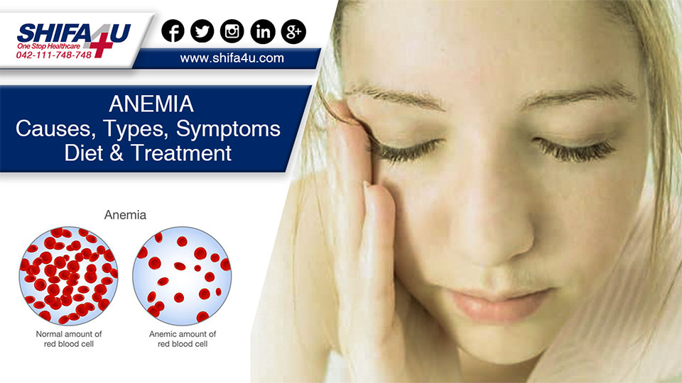 Anemia Causes Symptoms Types Diet And Treatment 4186