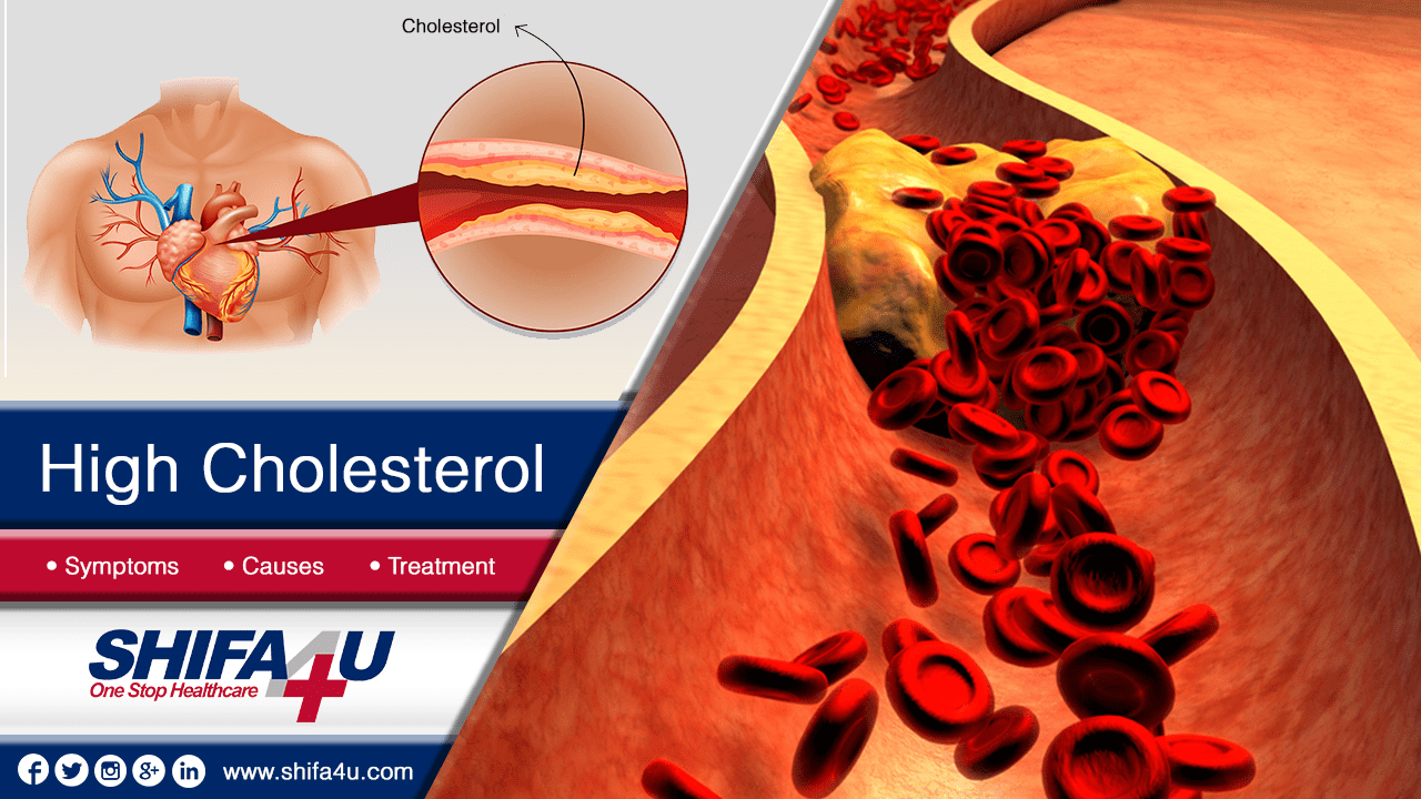 High Cholesterol Symptoms Causes Treatment 2782