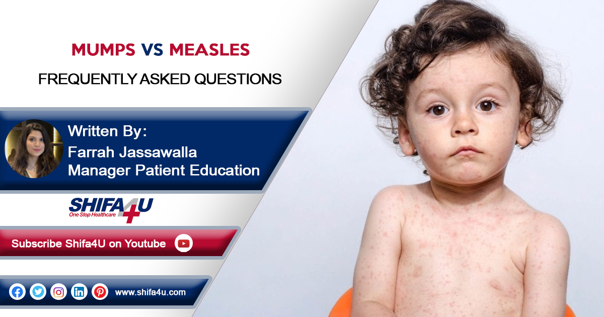 Mumps vs Measles