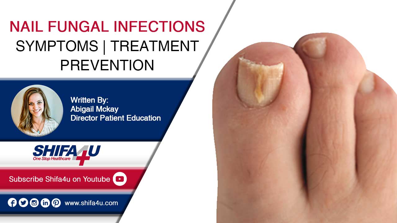 Nail Fungal Infections Symptoms Treatment Prevention