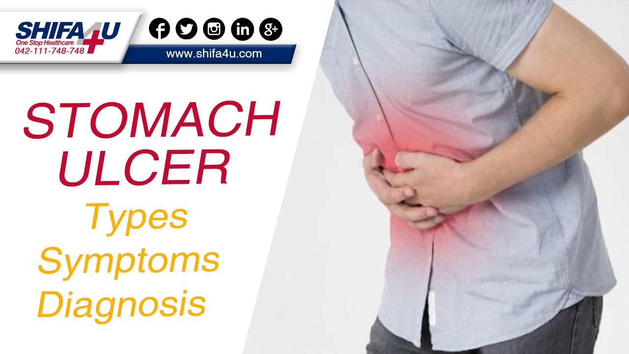 gastric ulcer types